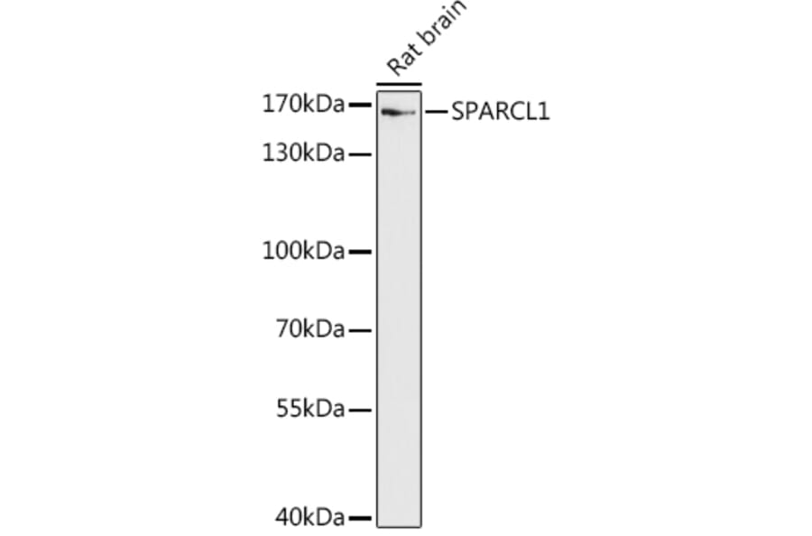 Western Blot - Anti-SPARCL1 Antibody (A306325) - Antibodies.com