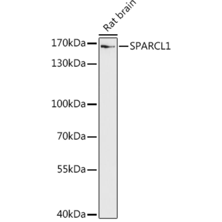 Western Blot - Anti-SPARCL1 Antibody (A306325) - Antibodies.com