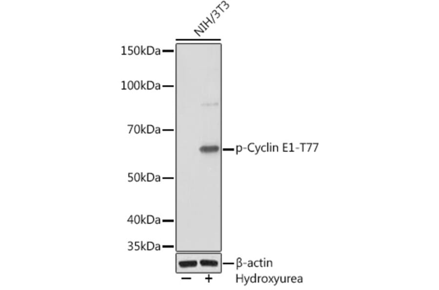 Western Blot - Anti-Cyclin E1 (phospho Thr77) Antibody [ARC1559] (A306326) - Antibodies.com
