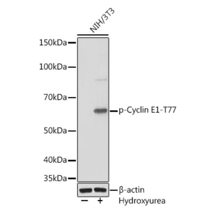 Western Blot - Anti-Cyclin E1 (phospho Thr77) Antibody [ARC1559] (A306326) - Antibodies.com