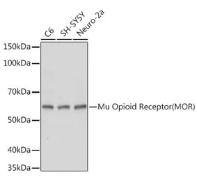 Western Blot - Anti-Mu Opioid Receptor Antibody (A306327) - Antibodies.com