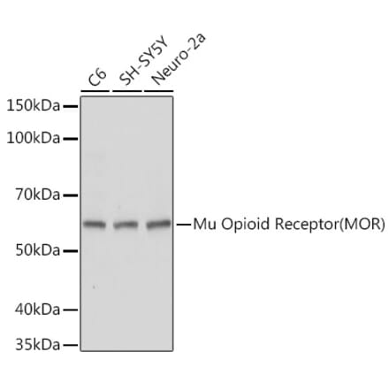 Western Blot - Anti-Mu Opioid Receptor Antibody (A306327) - Antibodies.com