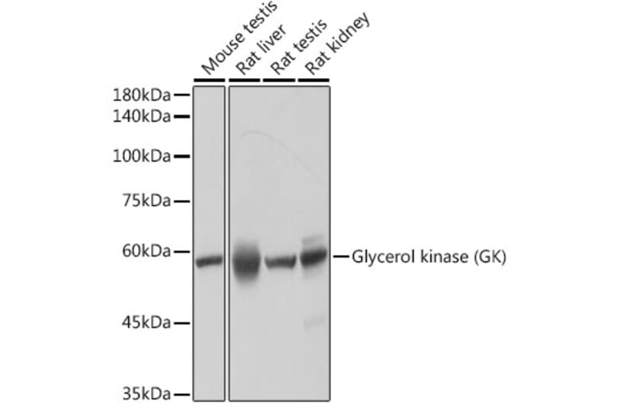 Western Blot - Anti-Glycerol kinase Antibody [ARC2376] (A306329) - Antibodies.com