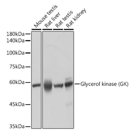 Western Blot - Anti-Glycerol kinase Antibody [ARC2376] (A306329) - Antibodies.com