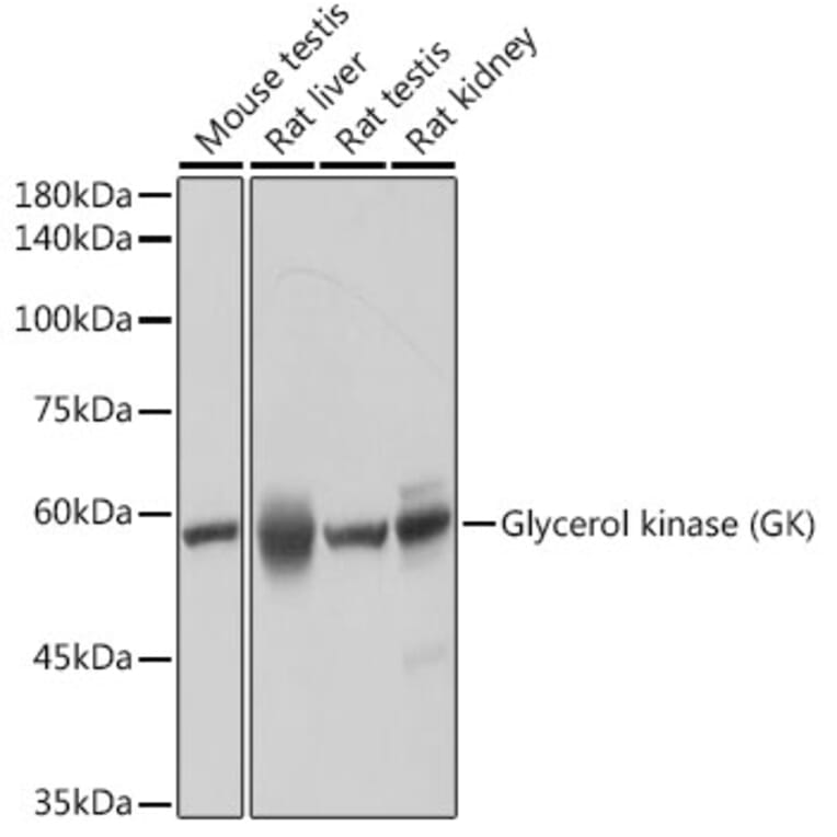 Western Blot - Anti-Glycerol kinase Antibody [ARC2376] (A306329) - Antibodies.com