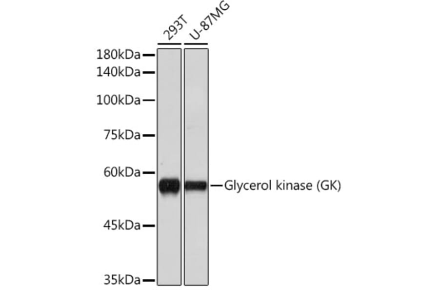 Western Blot - Anti-Glycerol kinase Antibody [ARC2376] (A306329) - Antibodies.com
