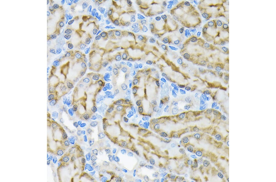 Immunohistochemistry - Anti-Glycerol kinase Antibody [ARC2376] (A306329) - Antibodies.com