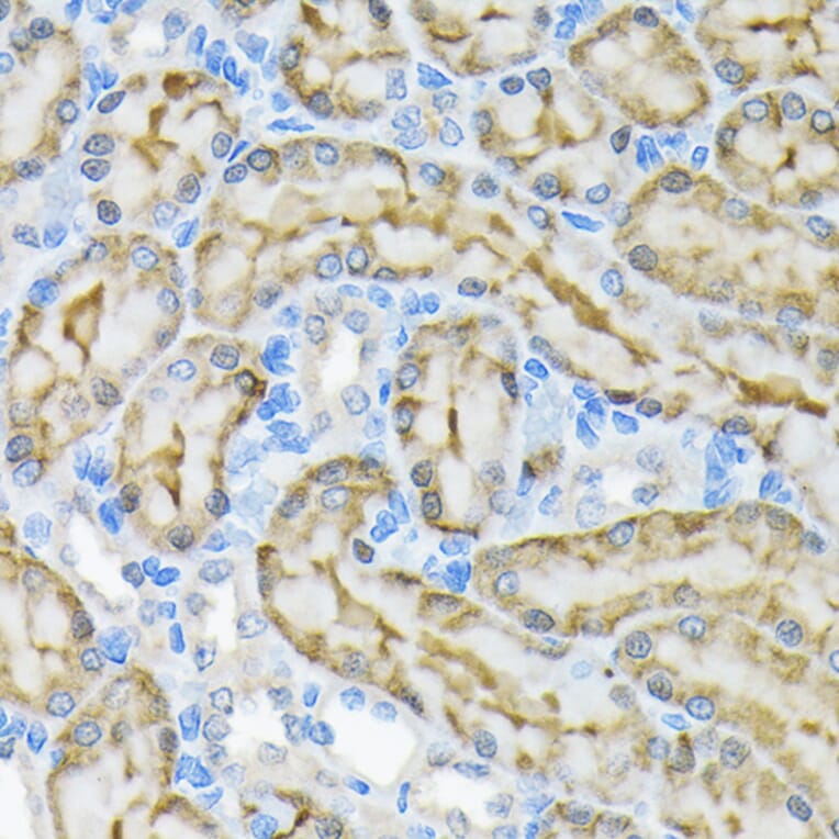 Immunohistochemistry - Anti-Glycerol kinase Antibody [ARC2376] (A306329) - Antibodies.com