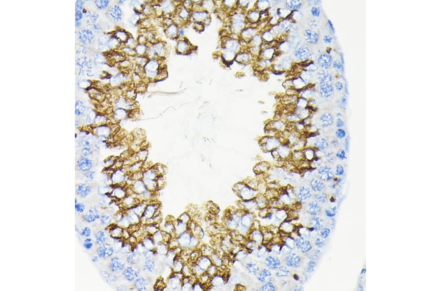 Immunohistochemistry - Anti-Glycerol kinase Antibody [ARC2376] (A306329) - Antibodies.com