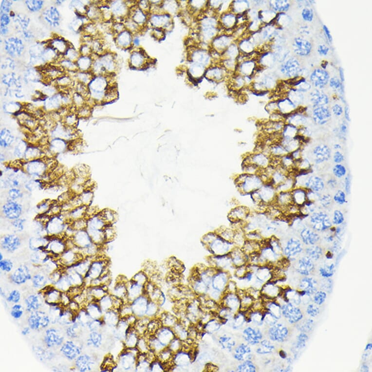 Immunohistochemistry - Anti-Glycerol kinase Antibody [ARC2376] (A306329) - Antibodies.com