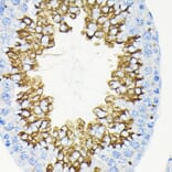 Immunohistochemistry - Anti-Glycerol kinase Antibody [ARC2376] (A306329) - Antibodies.com