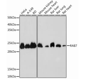 Western Blot - Anti-RAB7 Antibody [ARC0314] (A306330) - Antibodies.com