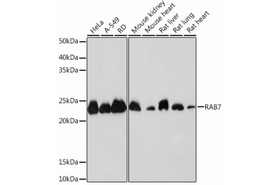 Western Blot - Anti-RAB7 Antibody [ARC0314] (A306330) - Antibodies.com