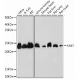 Western Blot - Anti-RAB7 Antibody [ARC0314] (A306330) - Antibodies.com