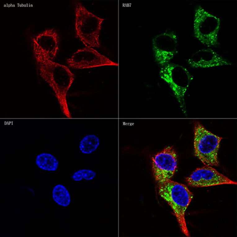 Immunofluorescence - Anti-RAB7 Antibody [ARC0314] (A306330) - Antibodies.com