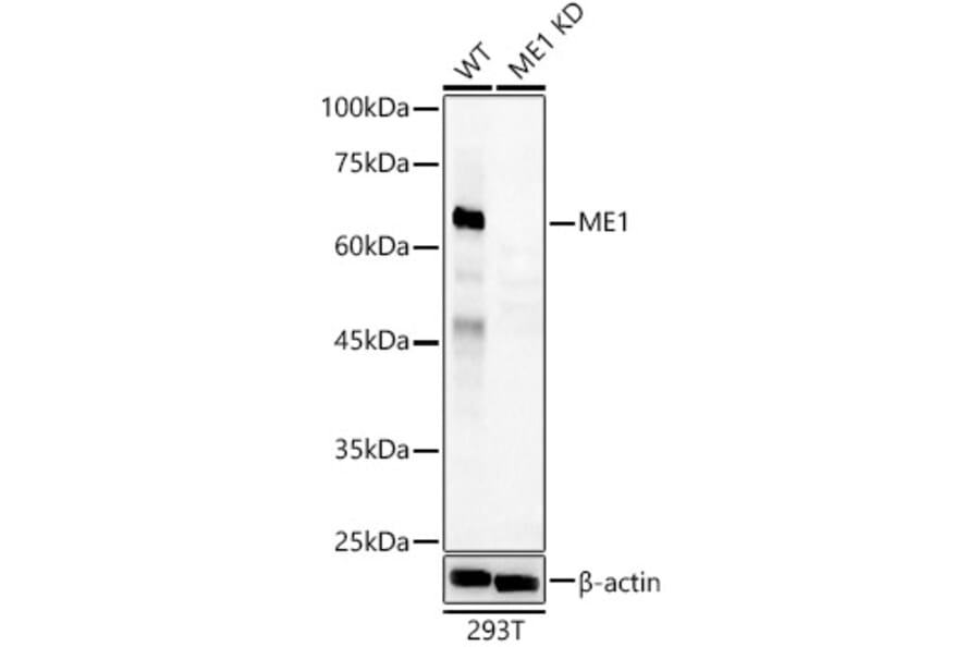 Western Blot - Anti-ME1 Antibody (A306331) - Antibodies.com