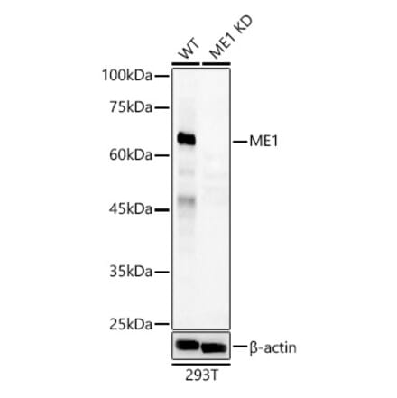 Western Blot - Anti-ME1 Antibody (A306331) - Antibodies.com