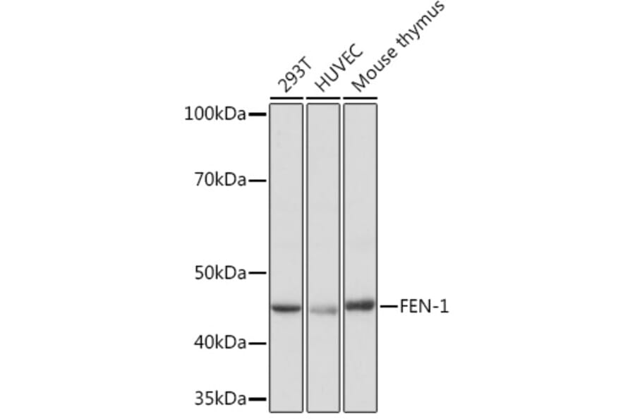 Western Blot - Anti-FEN1 Antibody [ARC1376] (A306332) - Antibodies.com