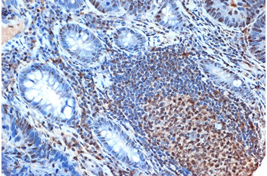 Immunohistochemistry - Anti-FEN1 Antibody [ARC1376] (A306332) - Antibodies.com