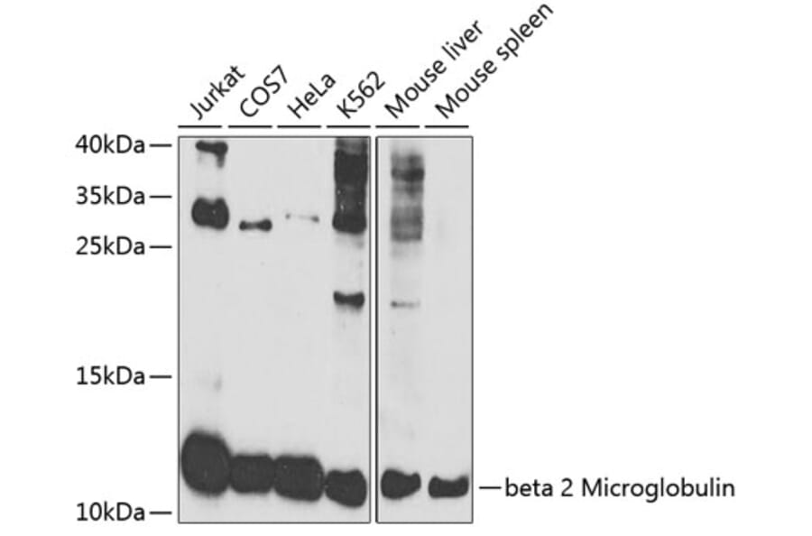 Western Blot - Anti-beta 2 Microglobulin Antibody (A306333) - Antibodies.com
