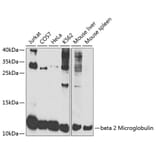 Western Blot - Anti-beta 2 Microglobulin Antibody (A306333) - Antibodies.com