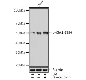 Western Blot - Anti-Chk1 (phospho Ser296) Antibody (A306334) - Antibodies.com