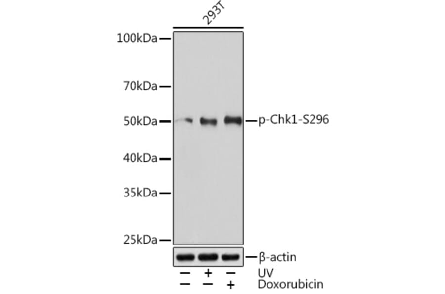Western Blot - Anti-Chk1 (phospho Ser296) Antibody [ARC1593] (A306334) - Antibodies.com