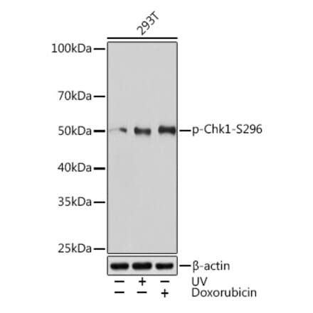 Western Blot - Anti-Chk1 (phospho Ser296) Antibody [ARC1593] (A306334) - Antibodies.com
