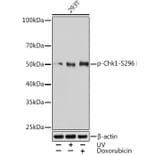 Western Blot - Anti-Chk1 (phospho Ser296) Antibody [ARC1593] (A306334) - Antibodies.com