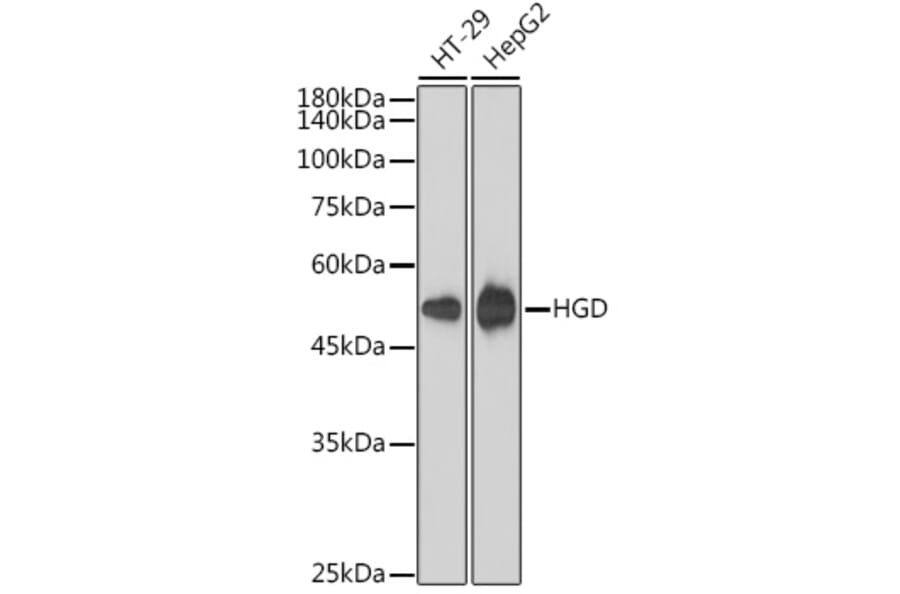 Western Blot - Anti-HGD Antibody [ARC2561] (A306335) - Antibodies.com
