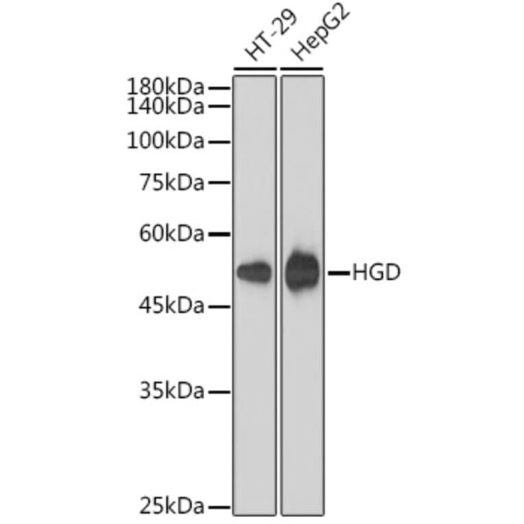 Western Blot - Anti-HGD Antibody [ARC2561] (A306335) - Antibodies.com