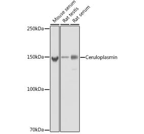 Western Blot - Anti-Ceruloplasmin Antibody [ARC5018-06] (A306336) - Antibodies.com