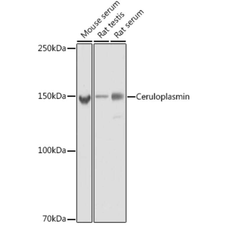 Western Blot - Anti-Ceruloplasmin Antibody [ARC5018-06] (A306336) - Antibodies.com