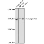 Western Blot - Anti-Ceruloplasmin Antibody [ARC5018-06] (A306336) - Antibodies.com