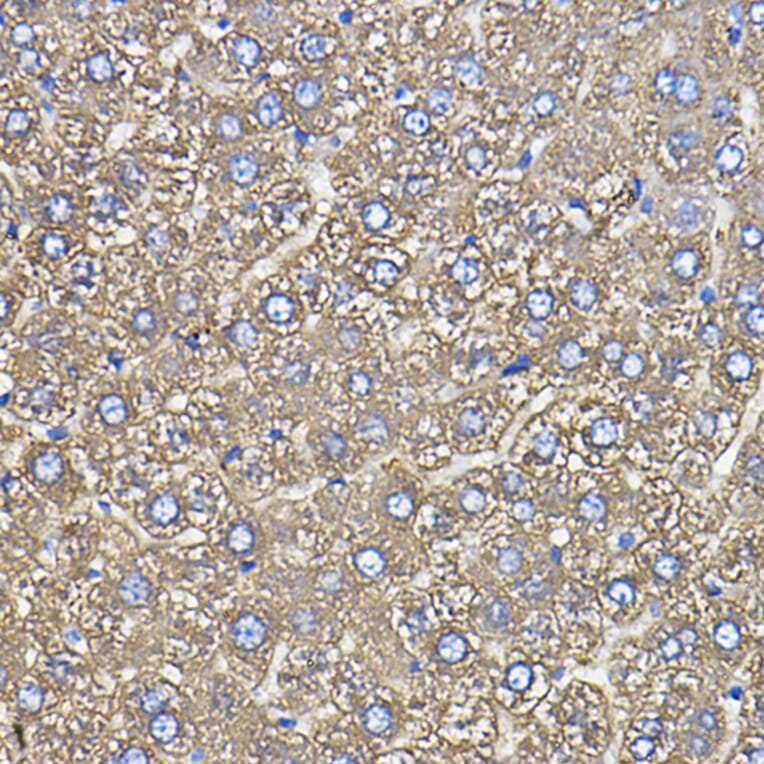 Immunohistochemistry - Anti-Ceruloplasmin Antibody [ARC5018-06] (A306336) - Antibodies.com