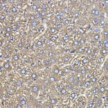 Immunohistochemistry - Anti-Ceruloplasmin Antibody [ARC5018-06] (A306336) - Antibodies.com