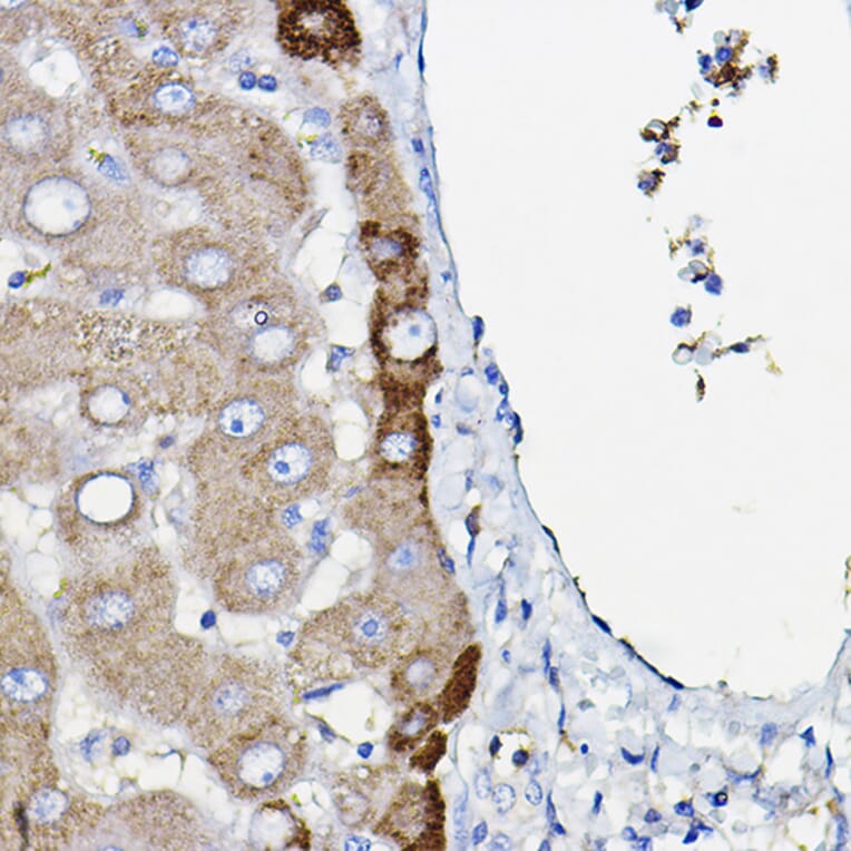 Immunohistochemistry - Anti-Ceruloplasmin Antibody [ARC5018-06] (A306336) - Antibodies.com