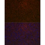 Immunofluorescence - Anti-Ceruloplasmin Antibody [ARC5018-06] (A306336) - Antibodies.com