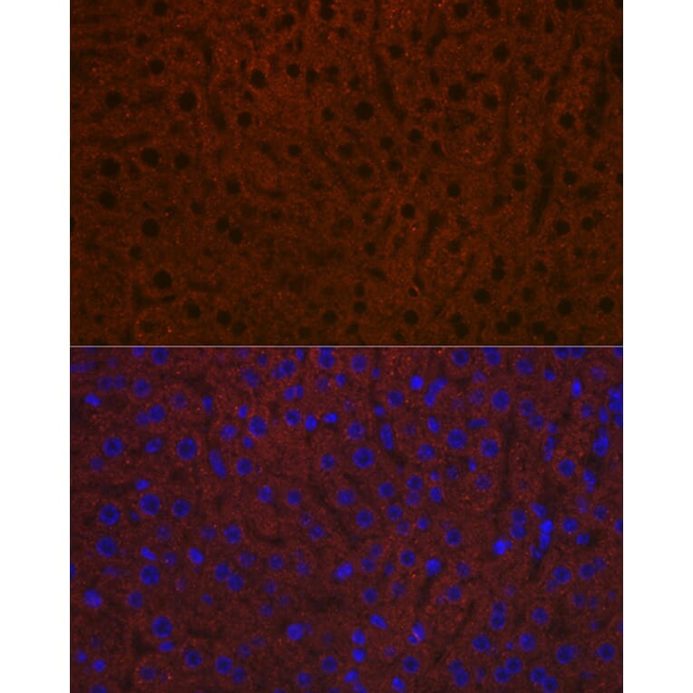 Immunofluorescence - Anti-Ceruloplasmin Antibody [ARC5018-06] (A306336) - Antibodies.com