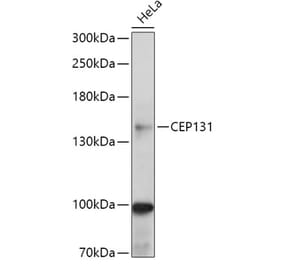 Western Blot - Anti-AZI1 Antibody (A306337) - Antibodies.com