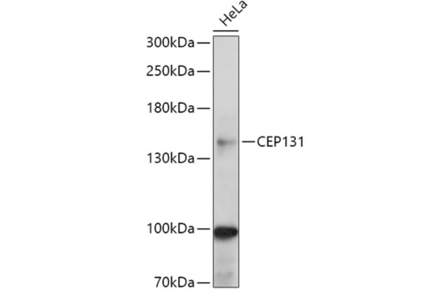 Western Blot - Anti-AZI1 Antibody (A306337) - Antibodies.com