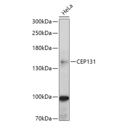 Western Blot - Anti-AZI1 Antibody (A306337) - Antibodies.com