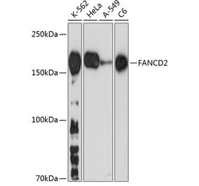 Western Blot - Anti-FANCD2 Antibody [ARC0172] (A306338) - Antibodies.com