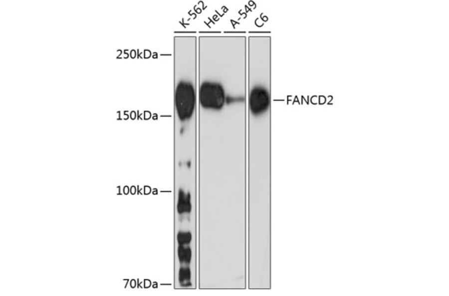 Western Blot - Anti-FANCD2 Antibody [ARC0172] (A306338) - Antibodies.com