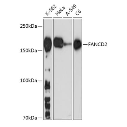 Western Blot - Anti-FANCD2 Antibody [ARC0172] (A306338) - Antibodies.com
