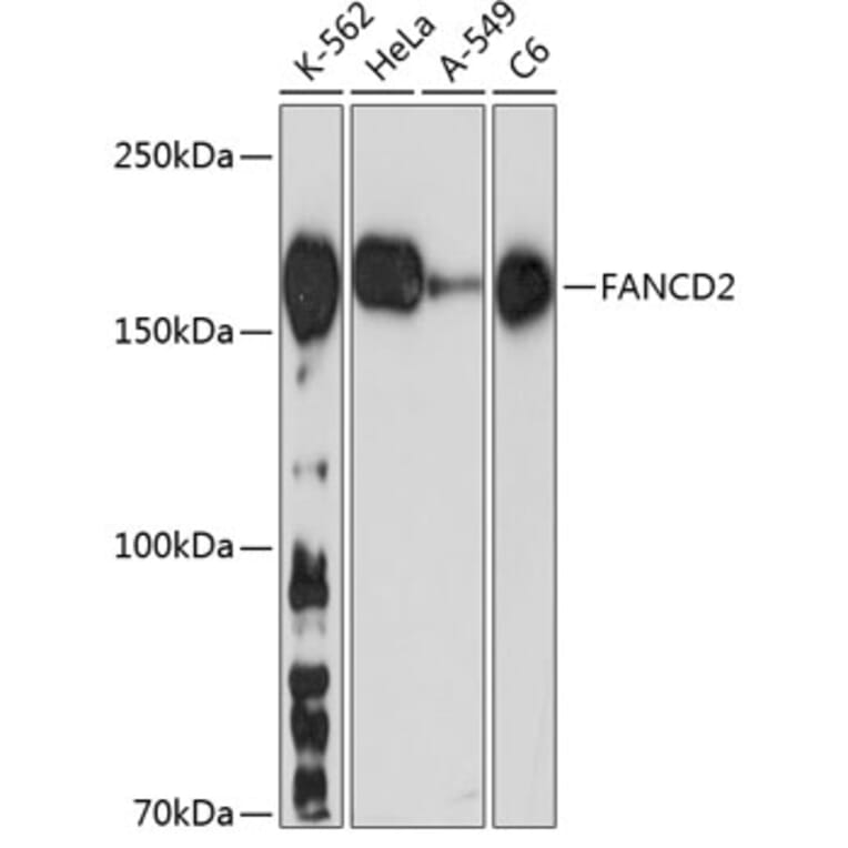 Western Blot - Anti-FANCD2 Antibody [ARC0172] (A306338) - Antibodies.com