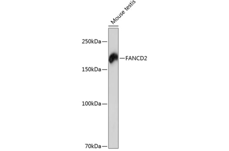 Western Blot - Anti-FANCD2 Antibody [ARC0172] (A306338) - Antibodies.com