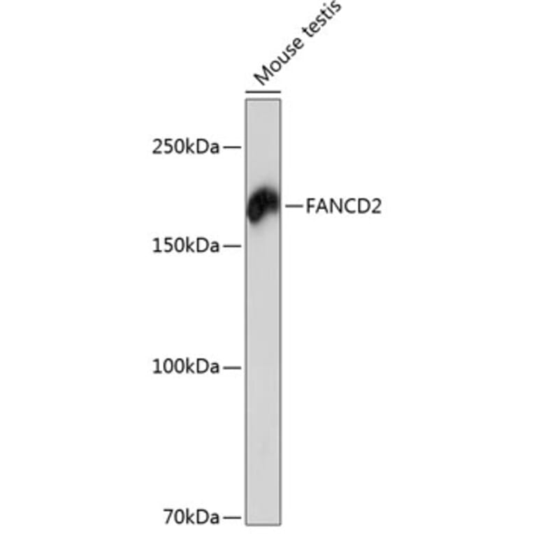 Western Blot - Anti-FANCD2 Antibody [ARC0172] (A306338) - Antibodies.com
