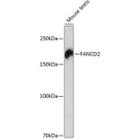 Western Blot - Anti-FANCD2 Antibody [ARC0172] (A306338) - Antibodies.com