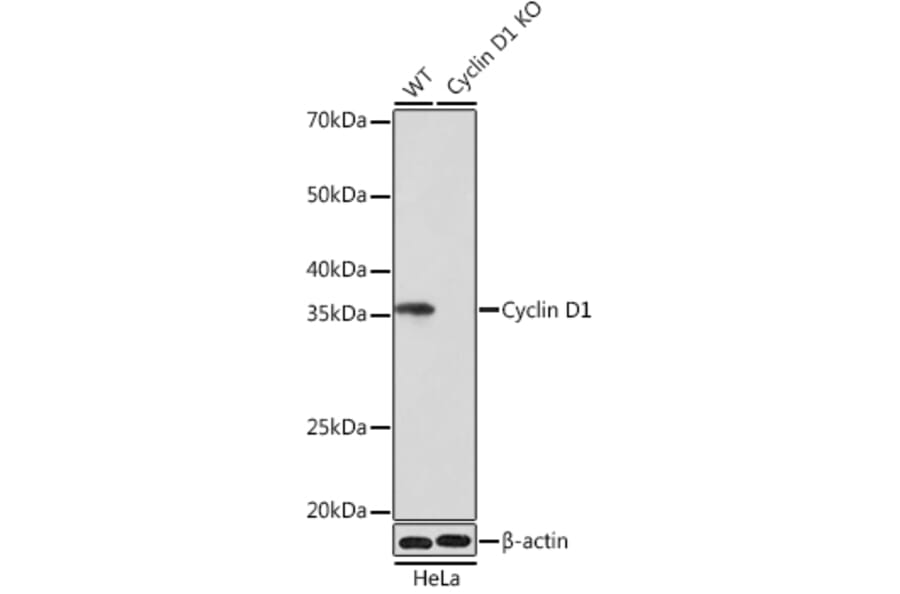 Western Blot - Anti-Cyclin D1 Antibody [ARC0300] (A306339) - Antibodies.com